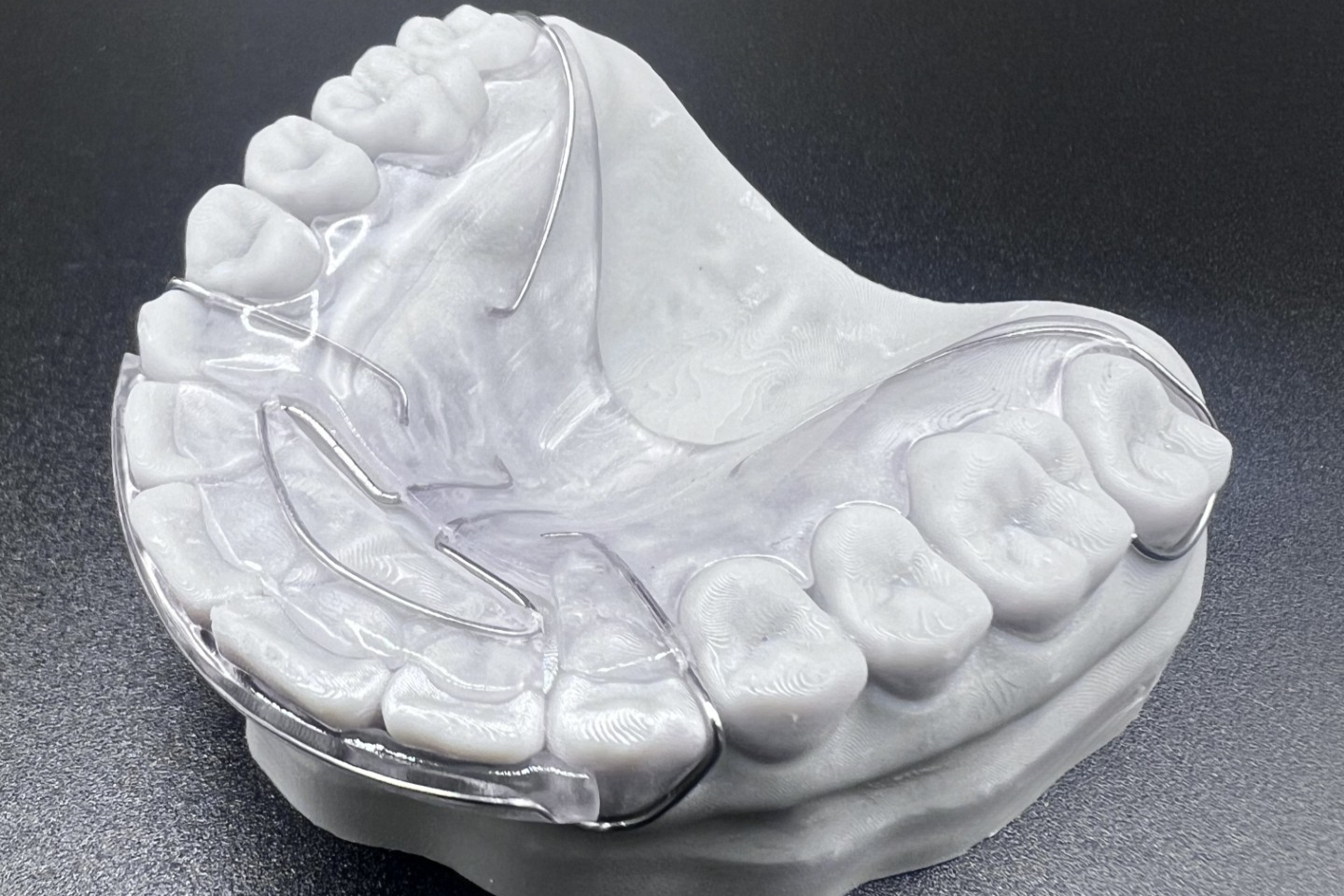 Hawley-style plate retainer with labial bow on stone model